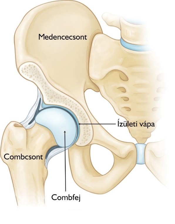 acetabularis fájdalom