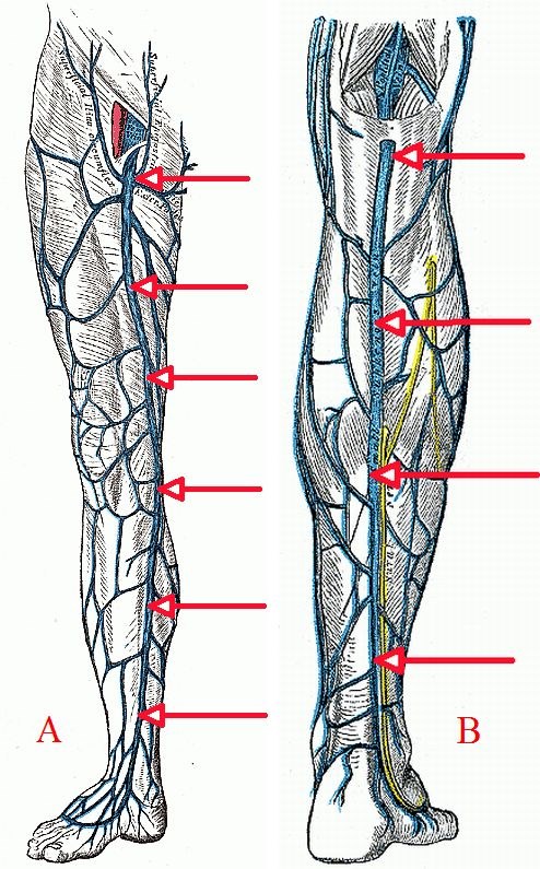 varicose vivasan
