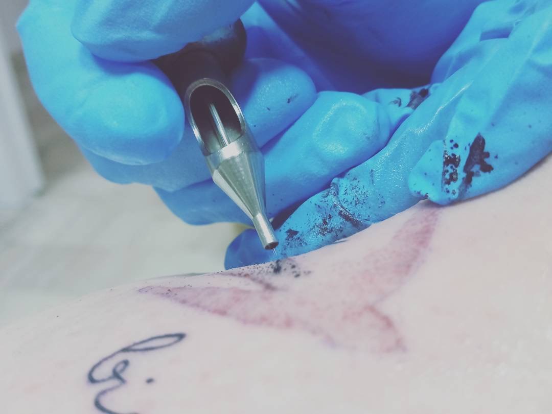 Un Tatuaggio Non E Per Sempre